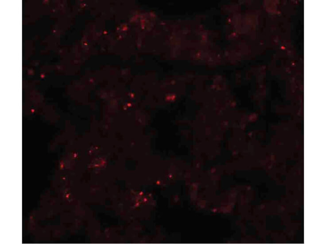PLEKHM1 Antibody in Immunocytochemistry (ICC/IF)