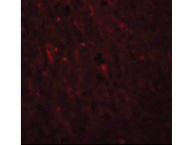 PLEKHM2 Antibody in Immunocytochemistry (ICC/IF)