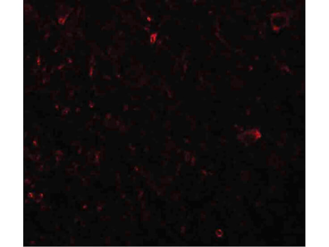 PLEKHM3 Antibody in Immunocytochemistry (ICC/IF)