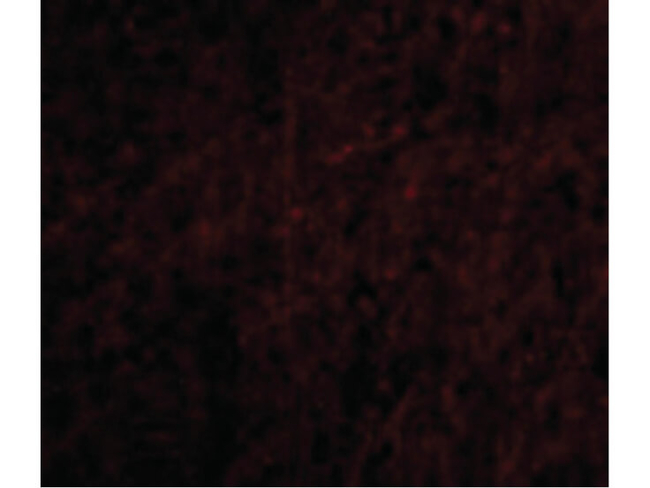 PLXDC2 Antibody in Immunocytochemistry (ICC/IF)