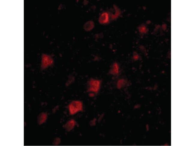 POLR3F Antibody in Immunocytochemistry (ICC/IF)