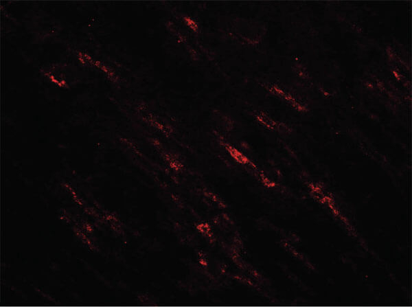 POU2F3 Antibody in Immunocytochemistry (ICC/IF)