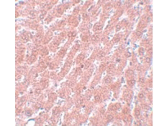 POU5F1 Antibody in Immunohistochemistry (Paraffin) (IHC (P))