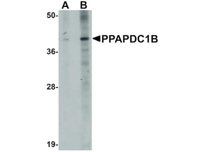 PPAPDC1B Antibody in Western Blot (WB)