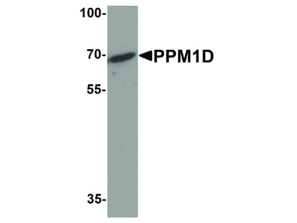 PPM1D Antibody in Western Blot (WB)