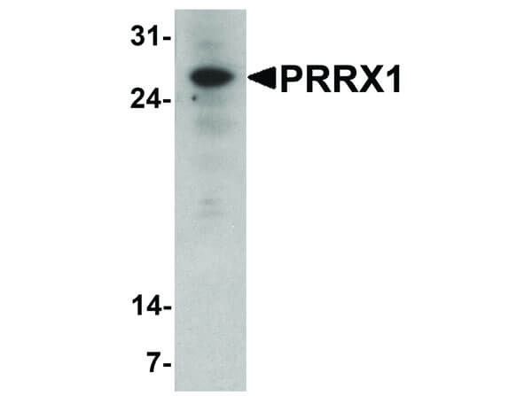 PRRX1 Antibody in Western Blot (WB)
