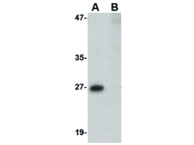 PRTFDC1 Antibody in Western Blot (WB)