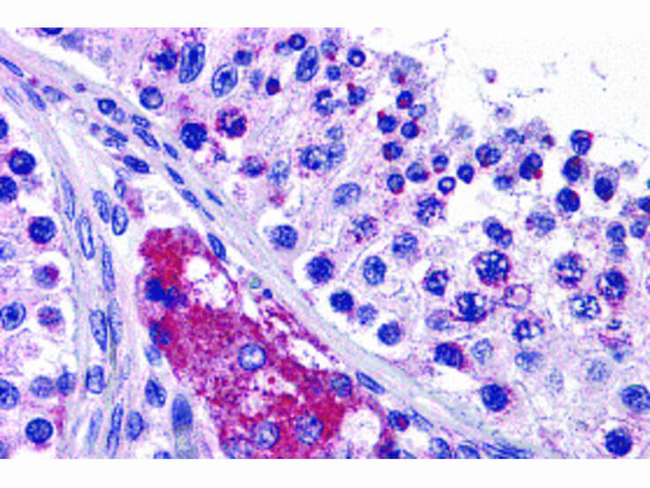 PTCHD2 Antibody in Immunohistochemistry (Paraffin) (IHC (P))