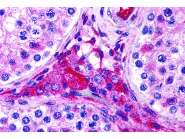 PTCHD2 Antibody in Immunohistochemistry (Paraffin) (IHC (P))