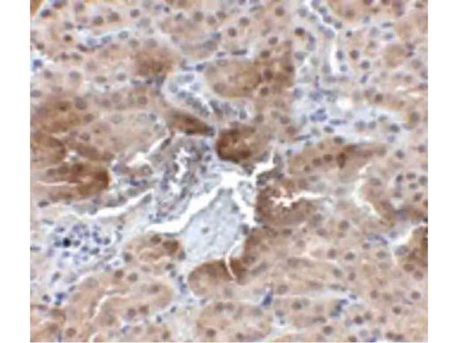 PTER Antibody in Immunohistochemistry (Paraffin) (IHC (P))