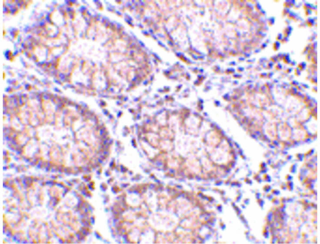 PTK7 Antibody in Immunohistochemistry (Paraffin) (IHC (P))