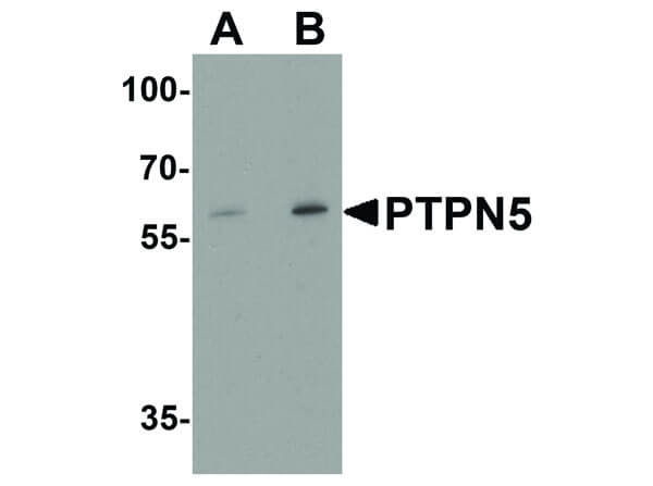 PTPN5 Antibody in Western Blot (WB)