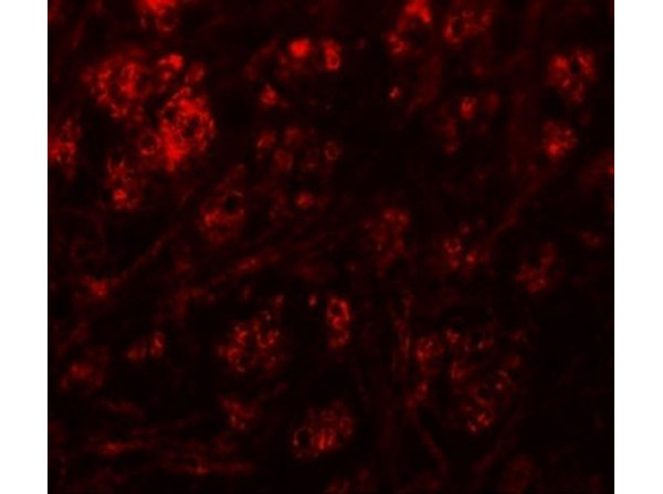 RABEX5 Antibody in Immunocytochemistry (ICC/IF)