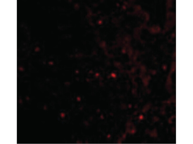 RAP80 Antibody in Immunocytochemistry (ICC/IF)