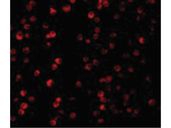 Raptor Antibody in Immunocytochemistry (ICC/IF)