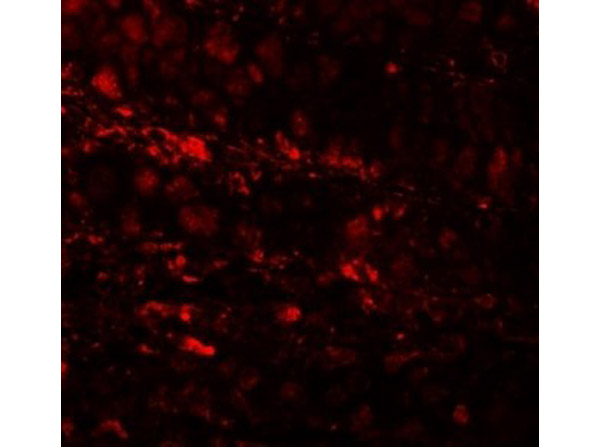 RBM35A Antibody in Immunocytochemistry (ICC/IF)