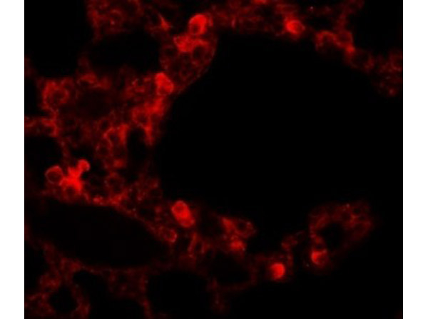 RBM35B Antibody in Immunocytochemistry (ICC/IF)