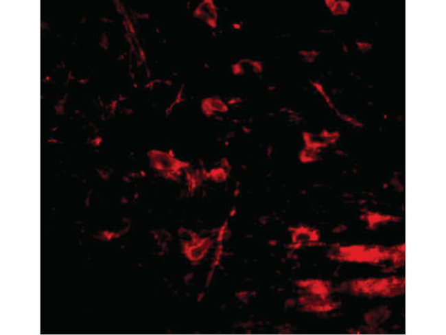 RCAN2 Antibody in Immunocytochemistry (ICC/IF)