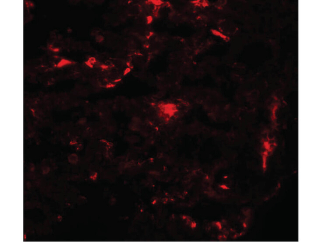 REEP2 Antibody in Immunocytochemistry (ICC/IF)