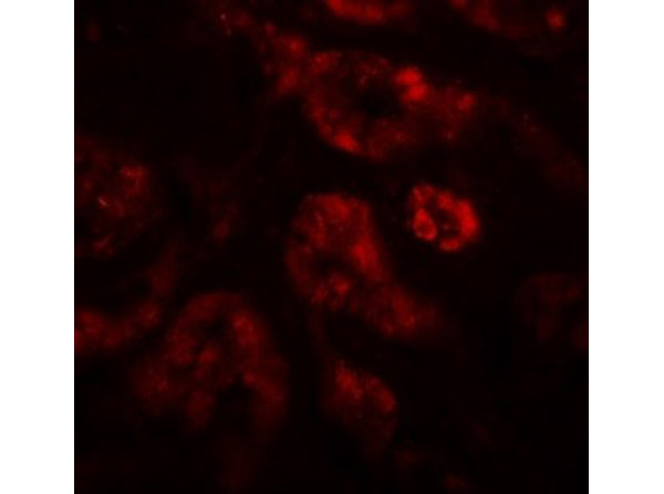 REQUIEM Antibody in Immunocytochemistry (ICC/IF)