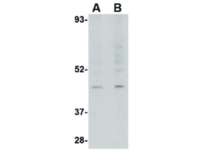 RGP1 Antibody in Western Blot (WB)