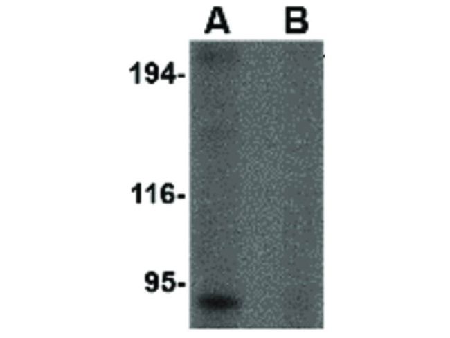 RGPD5 Antibody in Western Blot (WB)