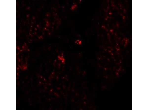 RHAMM Antibody in Immunocytochemistry (ICC/IF)