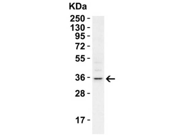 RHBDD1 Antibody in Western Blot (WB)