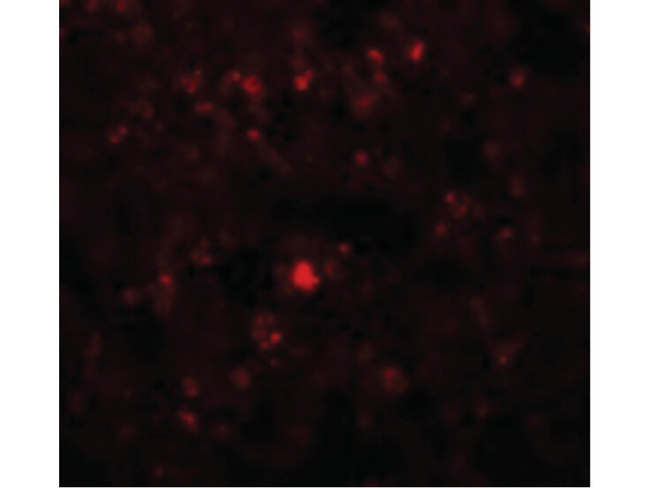 RHBDD2 Antibody in Immunocytochemistry (ICC/IF)