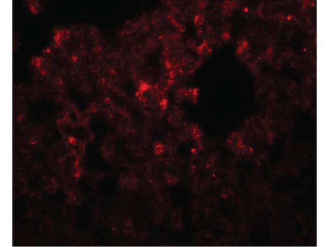 RHBDD3 Antibody in Immunocytochemistry (ICC/IF)