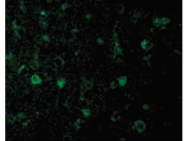 Rheb Antibody in Immunocytochemistry (ICC/IF)
