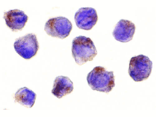 RICK Antibody in Immunocytochemistry (ICC/IF)