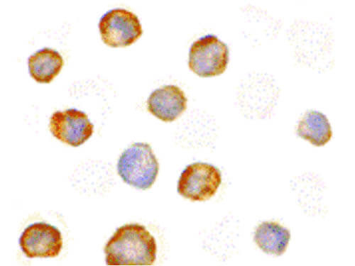 RICK Antibody in Immunocytochemistry (ICC/IF)