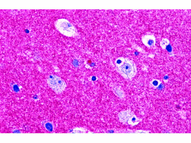 RIM2 Antibody in Immunohistochemistry (Paraffin) (IHC (P))