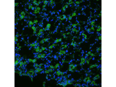 Aquaporin 1 Antibody in Immunocytochemistry (ICC/IF)
