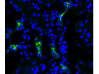 Aquaporin 2 Antibody in Immunocytochemistry (ICC/IF)