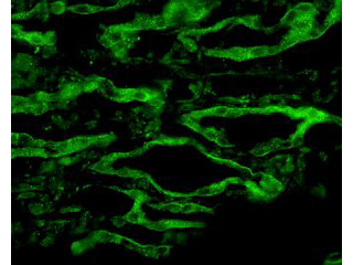 Aquaporin 4 Antibody in Immunocytochemistry (ICC/IF)