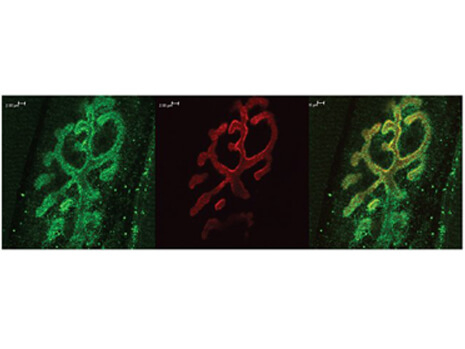 BASSOON Antibody in Immunohistochemistry (IHC)