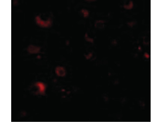 RIM2 Antibody in Immunocytochemistry (ICC/IF)
