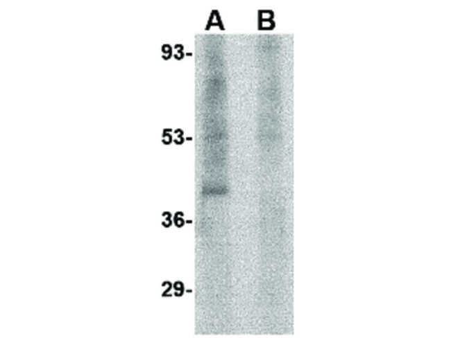 RIM3 Antibody in Western Blot (WB)
