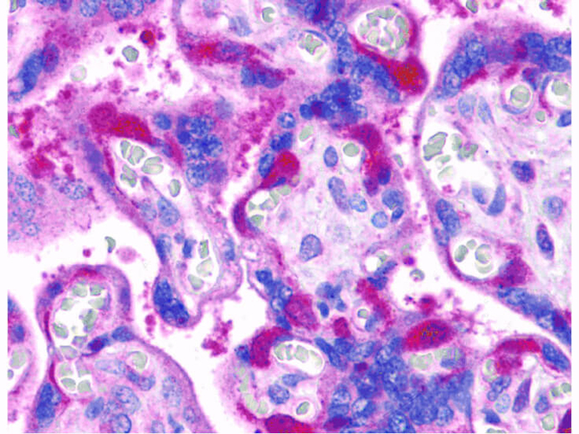 RIP1 Antibody in Immunohistochemistry (Paraffin) (IHC (P))
