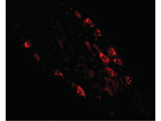 RKHD1 Antibody in Immunocytochemistry (ICC/IF)
