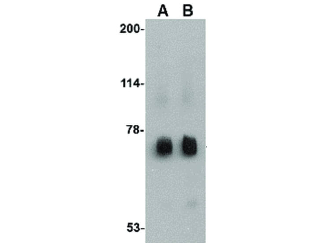 RKHD2 Antibody in Western Blot (WB)