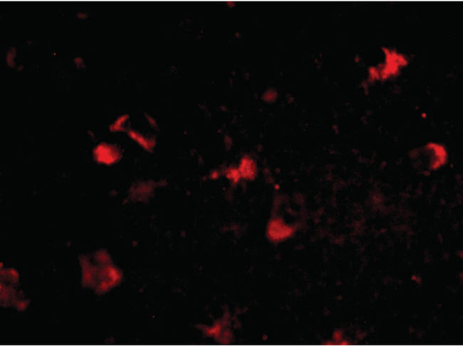 RKHD4 Antibody in Immunocytochemistry (ICC/IF)