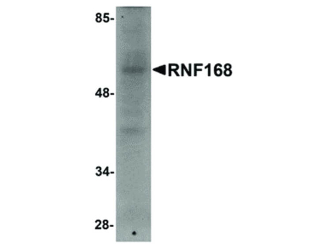 RNF168 Antibody in Western Blot (WB)