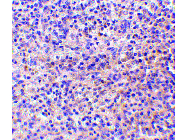 RP105 Antibody in Immunohistochemistry (Paraffin) (IHC (P))