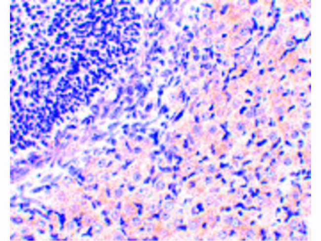 RPA Interacting Protein Antibody in Immunohistochemistry (Paraffin) (IHC (P))