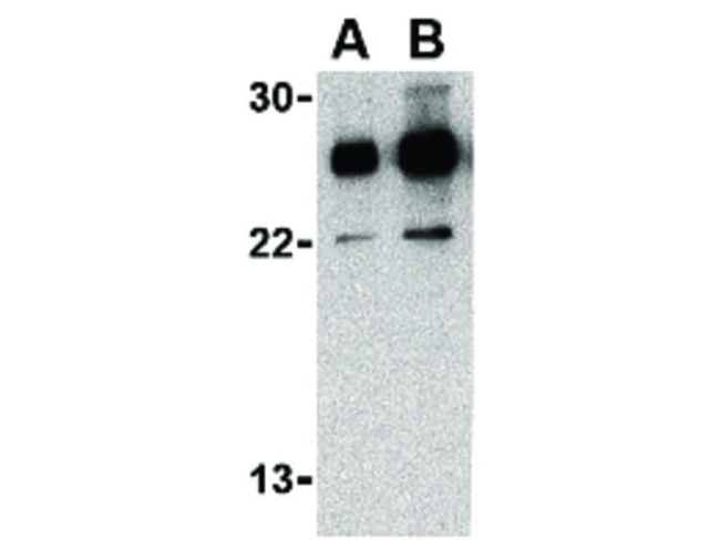 RPA Interacting Protein Antibody in Western Blot (WB)