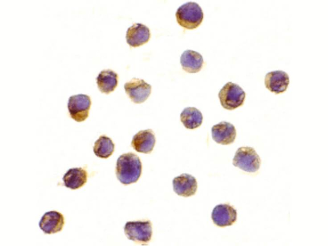 RPS6K1 Antibody in Immunocytochemistry (ICC/IF)