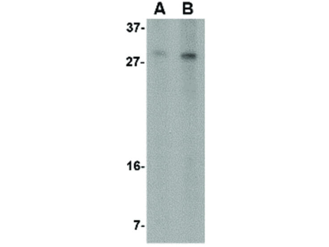 RTP801 Antibody in Western Blot (WB)